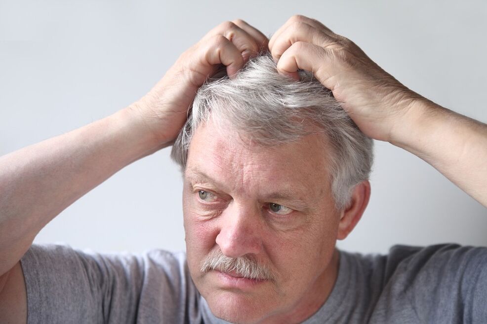 Psoriasis-Symptome am Kopf