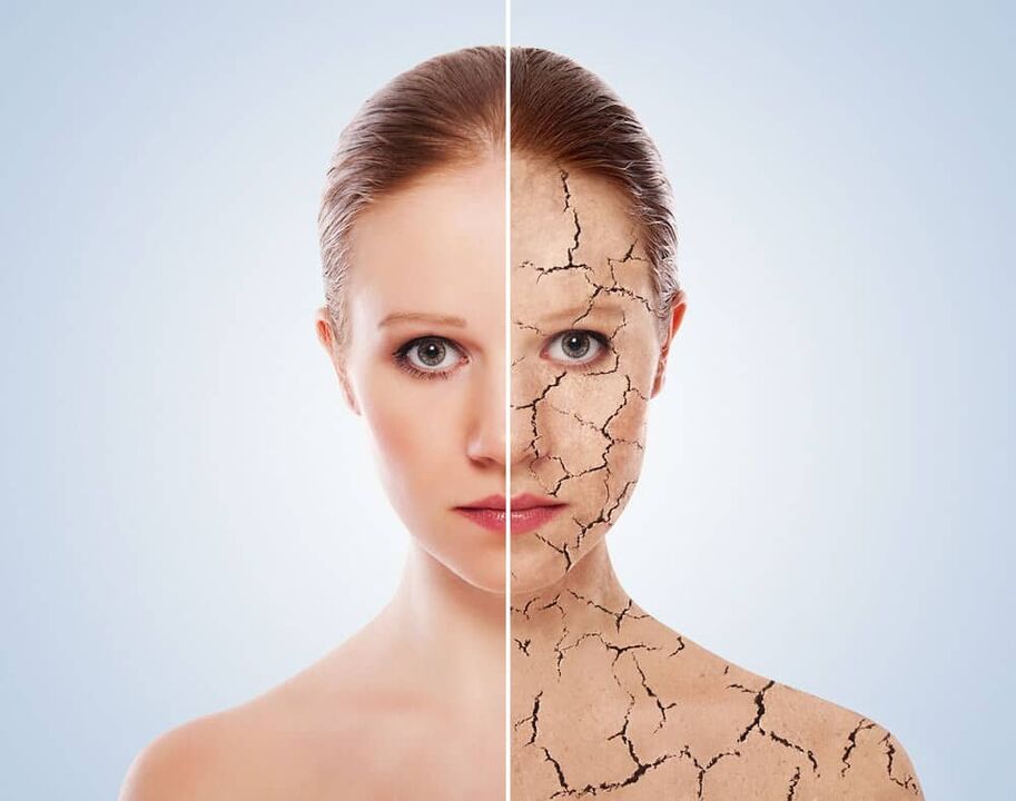 Gesunde Haut und von Psoriasis betroffene Haut
